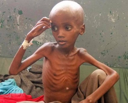 starving-kid.jpg